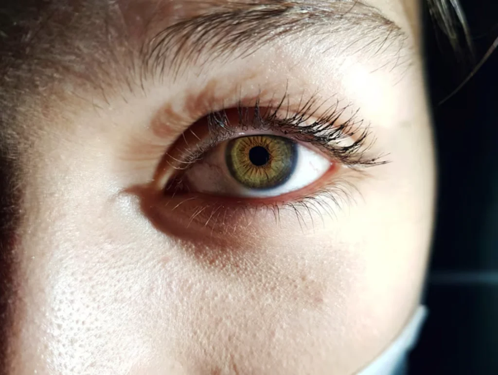 Действие метадона с демонстрацией на зрачках пациента